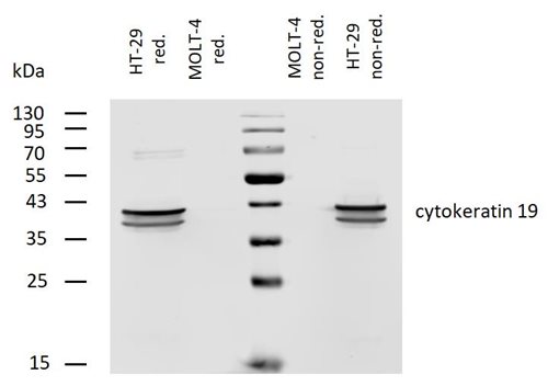 Anti-Cytokeratin 19 Monoclonal Antibody (Clone:A53-B/A2)-Biotin Conjugated