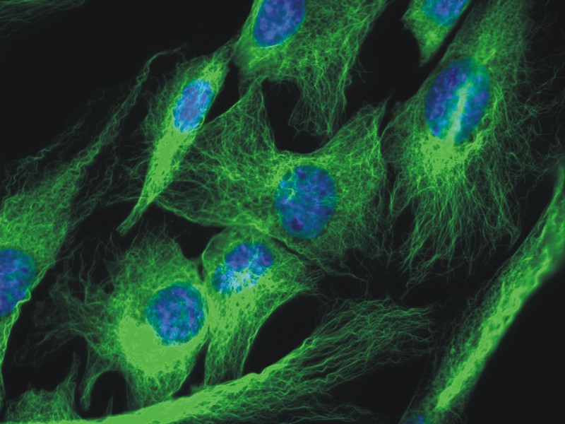 Figure 3: Immunofluorescence staining of 3T3 mouse embryonal fibroblast cell line using anti-alpha-tubulin (TU-01; green). Nucleus is stained with DAPI (blue).