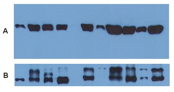 Figure 4:Use of anti-alpha-tubulin antibody TU-01 as a loading control (A) in an Western blotting experiment revealing the staining pattern of various cell lysates by a newly developed monoclonal antibody (B).