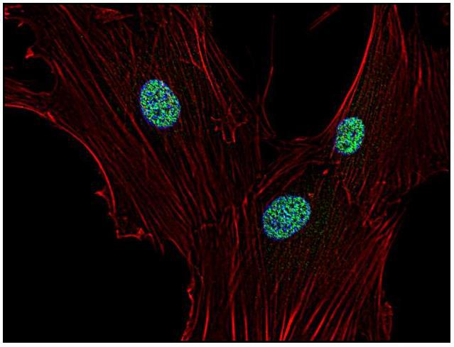 Figure 2 : Immunocytochemistry staining of p21 in human primary fibroblasts using anti-p21 (WA-1; green). Actin cytoskeleton decorated by phalloidin (red) and cell nuclei stained with DAPI (blue).