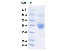 Recombinant Human Clusterin Protein (sCLU, His Tag) Recombinant Human Clusterin Protein (sCLU, His Tag)