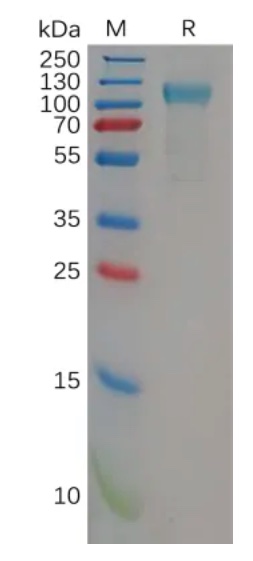 Recombinant Human TLR3 Human (C-Term His Tag)