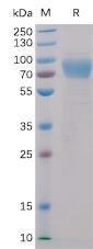 Recombinant human 2B4 protein with C-terminal mouse Fc and 6×His tag