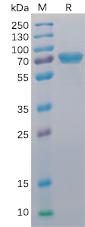 Figure 1. Human CD40 Protein, mFc-His Tag on SDS-PAGE under reducing condition.