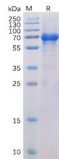 Recombinant human OX40 protein with C-terminal human Fc and 6×His tag