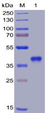 Recombinant SARS-CoV-2 (2019-nCoV) S protein RBD with 6Ã—His tag
