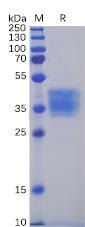 Recombinant human CLDN6 Protein with C-terminal mouse Fc Tag
