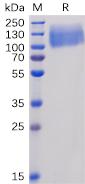 Recombinant human CEACAM5 protein with C-terminal 6×His tag
