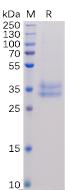 Recombinant human IL2RB protein with C-terminal 6×His Fc tag