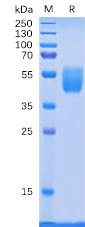 Recombinant human PSCA protein with C-terminal human Fc