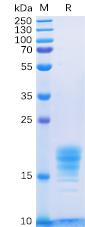 Recombinant Human IL5 protein with C-terminal 6×His tag