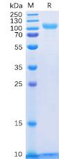 Recombinant Human HER3 protein with C-terminal 6×His tag