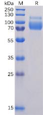 Recombinant Human SIGLEC10 protein with C-terminal 6×His tag