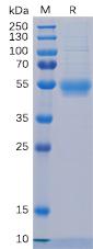 Recombinant human L5RA protein with C-terminal 6×His tag