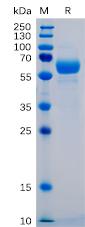 Recombinant human SIGLEC15 protein with C-terminal mouse Fc and 6×His tag