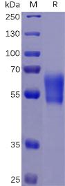 Figure 1. Human PD-1 Protein, hFc-His Tag on SDS-PAGE under reducing condition.