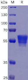 Recombinant human CD7 protein with C-terminal mouse Fc tag