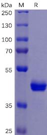 Recombinant human TNFRSF10B protein with C-terminal Mouse Fc tag