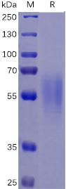 Recombinant human IL17RA protein with C-terminal 6×His tag