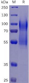 Recombinant human CD34 protein with C-terminal 6×His tag
