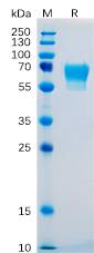 Recombinant human CD27 protein with C-terminal human Fc tag