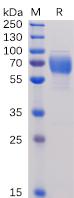 Recombinant human 2B4 protein with C-terminal human Fc tag
