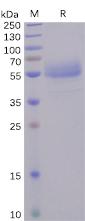 Recombinant human ICOS protein with C-terminal human Fc tag