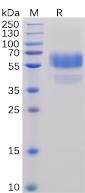 Recombinant human CD70 protein with C-terminal human Fc and 6×His tag