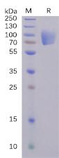 Recombinant SARS-CoV-2 (2019-nCoV) S1 protein NTD with C-terminal mouse Fc tag