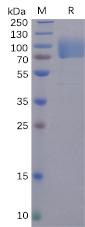 Recombinant SARS-CoV-2 (2019-nCoV) S1 protein NTD with C-terminal human Fc tag