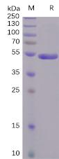Recombinant SARS-CoV-2 (2019-nCoV) S1 protein CTD with C-terminal human Fc tag