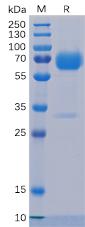 Recombinant human Trop2 protein with C-terminal mouse Fc and 6×His tag