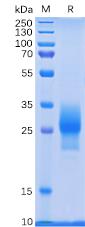 Recombinant human 4-1BB protein with C-terminal 6×His tag