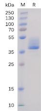 Recombinant Human BAFF-R protein with C-terminal human Fc