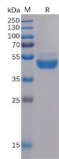 Figure 1. Human TIGIT Protein, mFc Tag on SDS-PAGE under reducing condition.