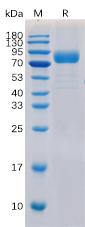 Recombinant human CD19 Protein with C-Human Fc and 6×His tag