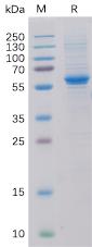 Recombinant human ROR2 Protein with C-6×His tag