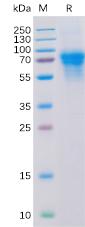Recombinant human CD46 Protein with C-6×His tag