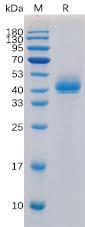Recombinant human TGFBR1 Protein with N-Human Fc tag