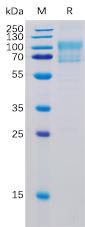 Recombinant Human B7-1 Protein with C-terminal Mouse Fc and 6×His tag