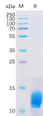 Recombinant Human MUC1 Protein with C-terminal 6×His tag