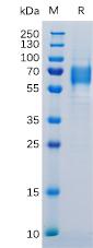 Figure 1. Human IL6R Protein, His Tag on SDS-PAGE under reducing condition.