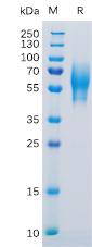 Recombinant Human 5T4 Protein with C-terminal 6×His tag