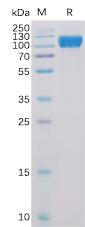 Recombinant Human ACE2 Protein with N-terminal 6×His tag