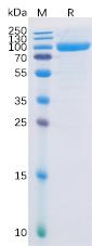 Recombinant human FAP Protein with N-terminal His Tag