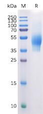Recombinant Human CD44 Protein with C-terminal 6×His tag