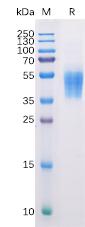 Figure 1. Human B7-H6 Protein, His Tag on SDS-PAGE under reducing condition.