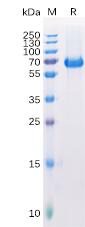 Recombinant Human EPHA2 Protein with C-terminal 6×His tag