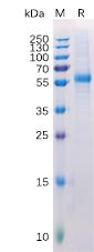 Recombinant Human LAG3 Protein with C-terminal 6×His tag