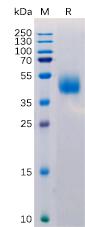 Recombinant Human MICB Protein with C-terminal 6×His tag